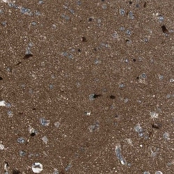 TIAM2 Antibody, Novus Biologicals 0.1mL; Unlabeled:Antibodies, Polyclonal